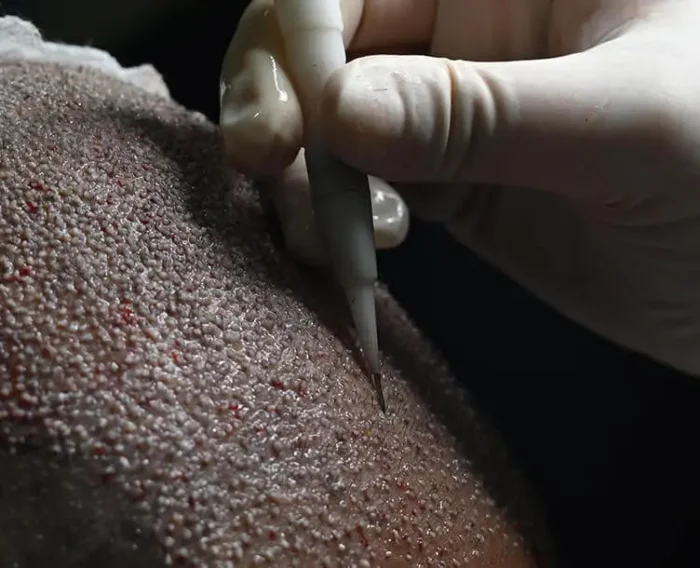 dhi transplant banner