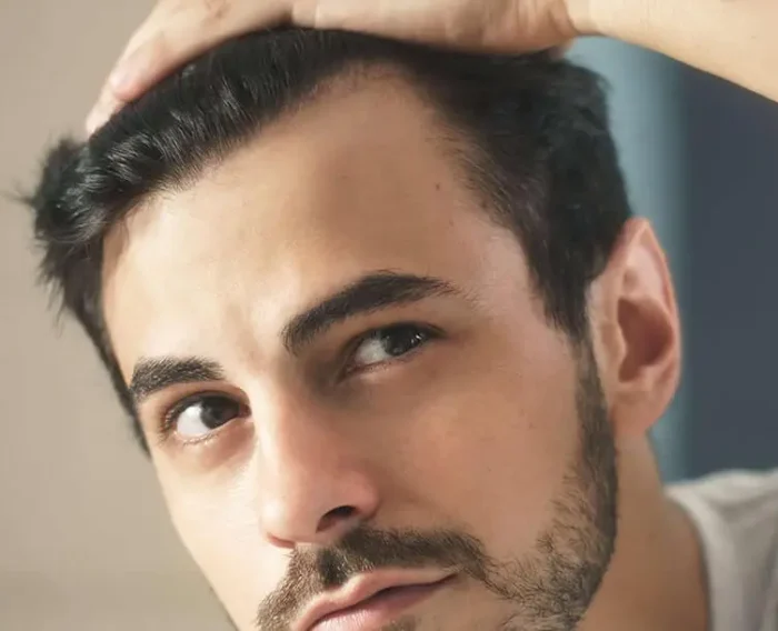 hair transplant banner