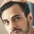 hair transplant banner