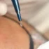 sapphire fue hair transplant banner