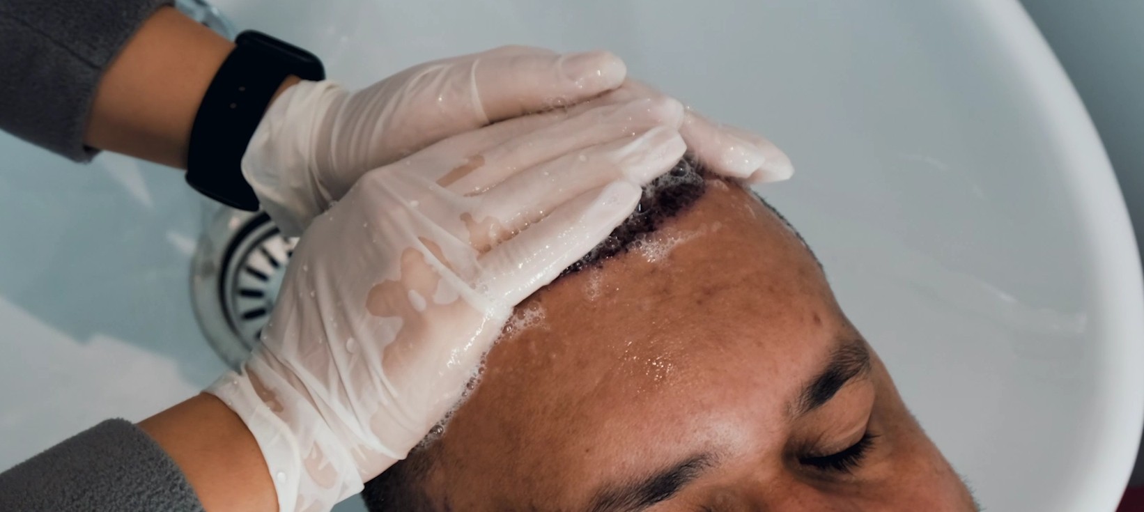 How to Wash Your Hair After a Hair Transplant