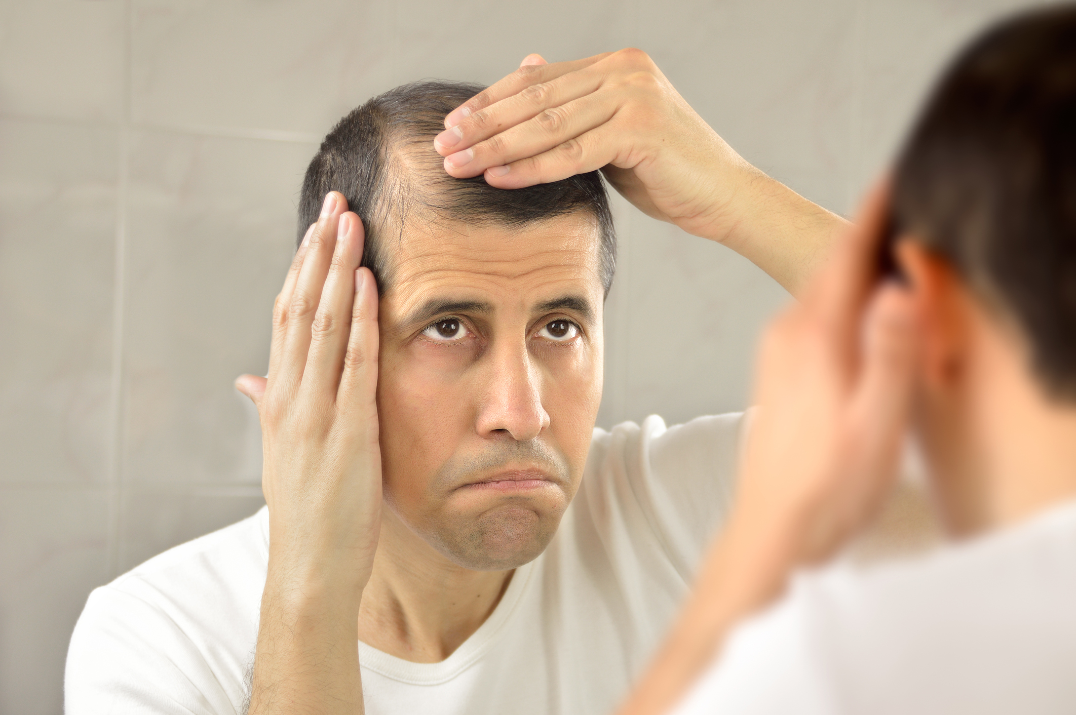 How Many Hair Transplant Sessions Do You Actually Need?