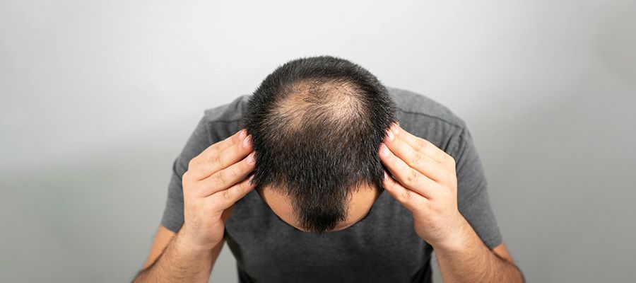 Patient consultation comparing crown and hairline restoration options