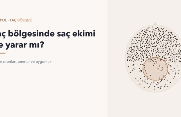 Taç bölgesi işaretlenmiş tepeden saçlı deri diyagramı