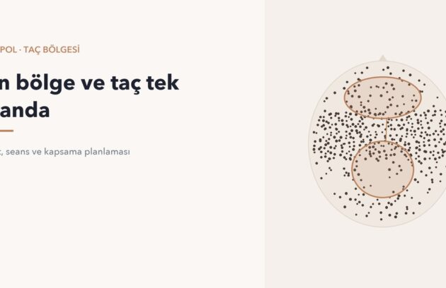 Ön bölge ve taç bölgesinin birlikte planlandığını gösteren diyagram