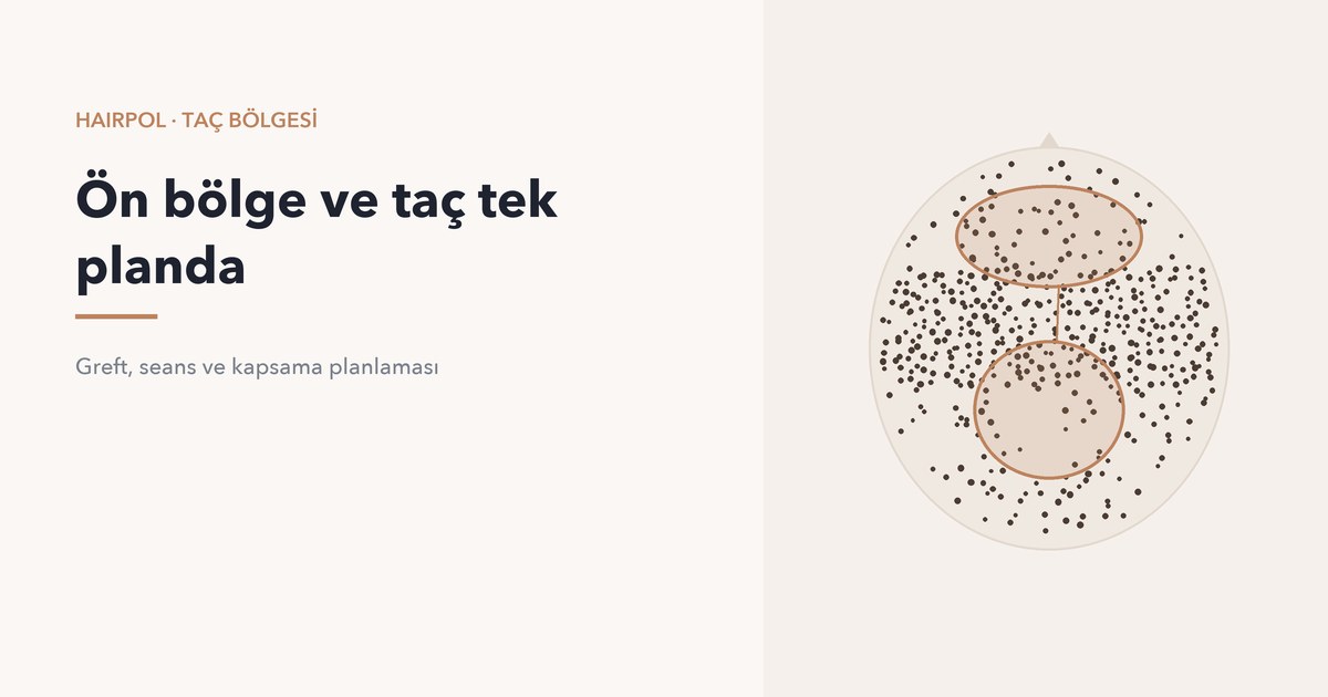 Ön bölge ve taç bölgesinin birlikte planlandığını gösteren diyagram