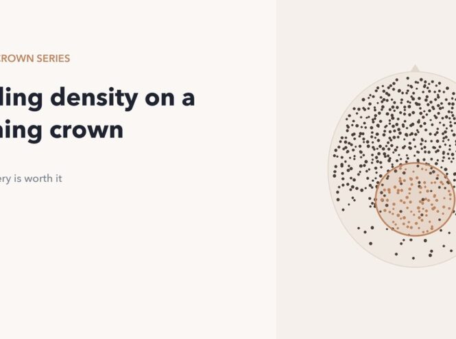 Grafts added to a thinning crown to rebuild density