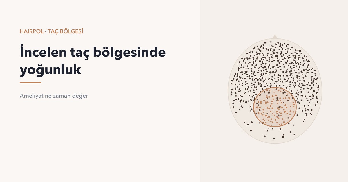 İncelen taç bölgesine yoğunluk için eklenen greftler