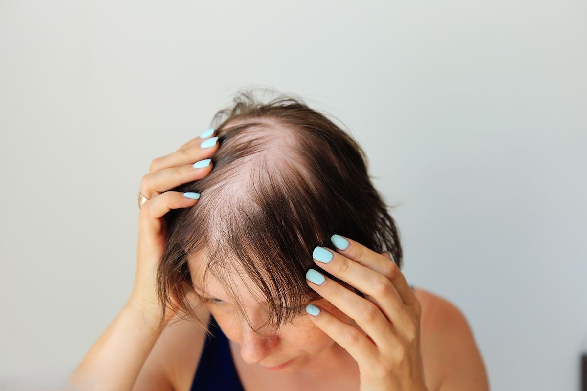 Woman examining thinning hair at the part line during menopause