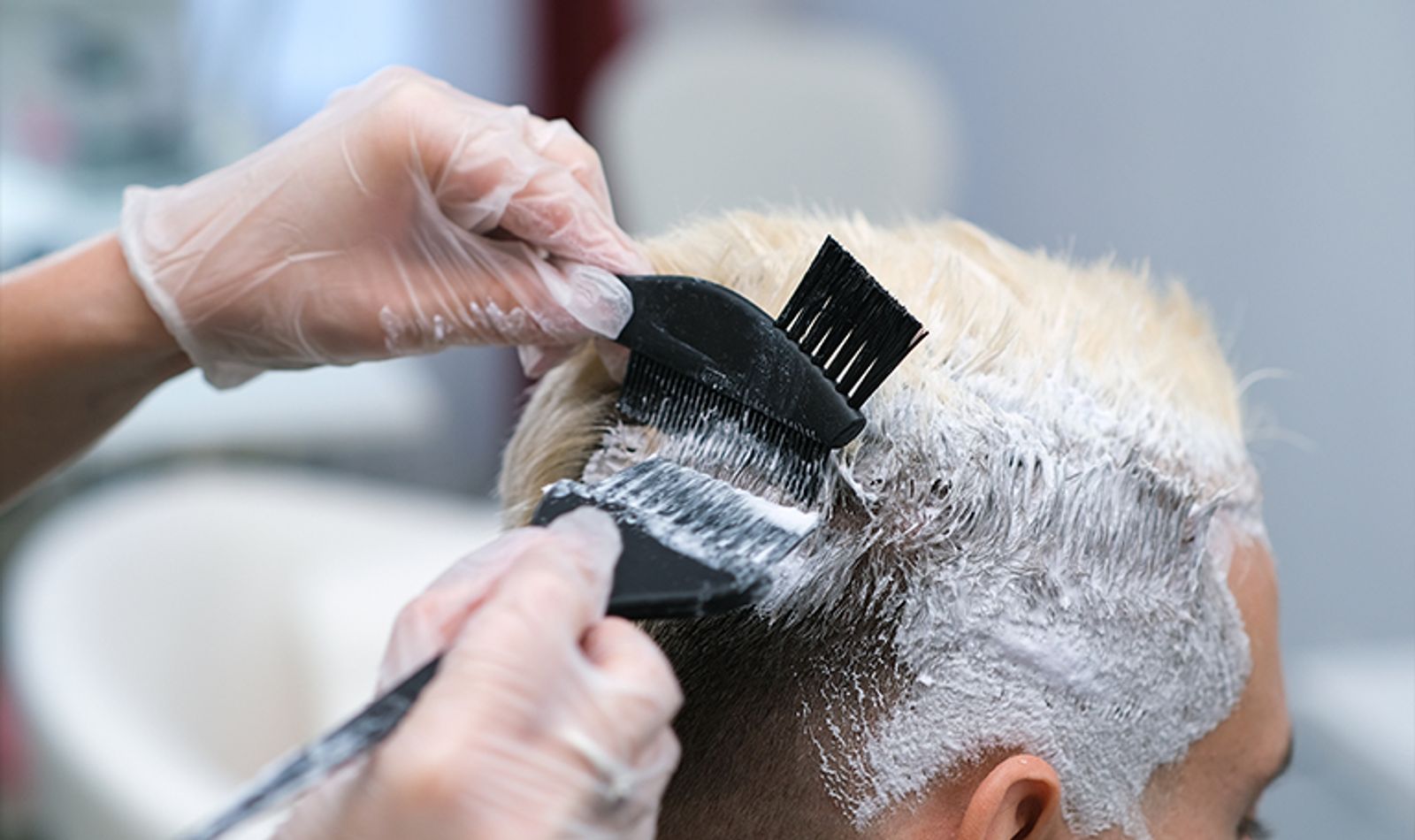 Man having his hair coloured after a hair transplant