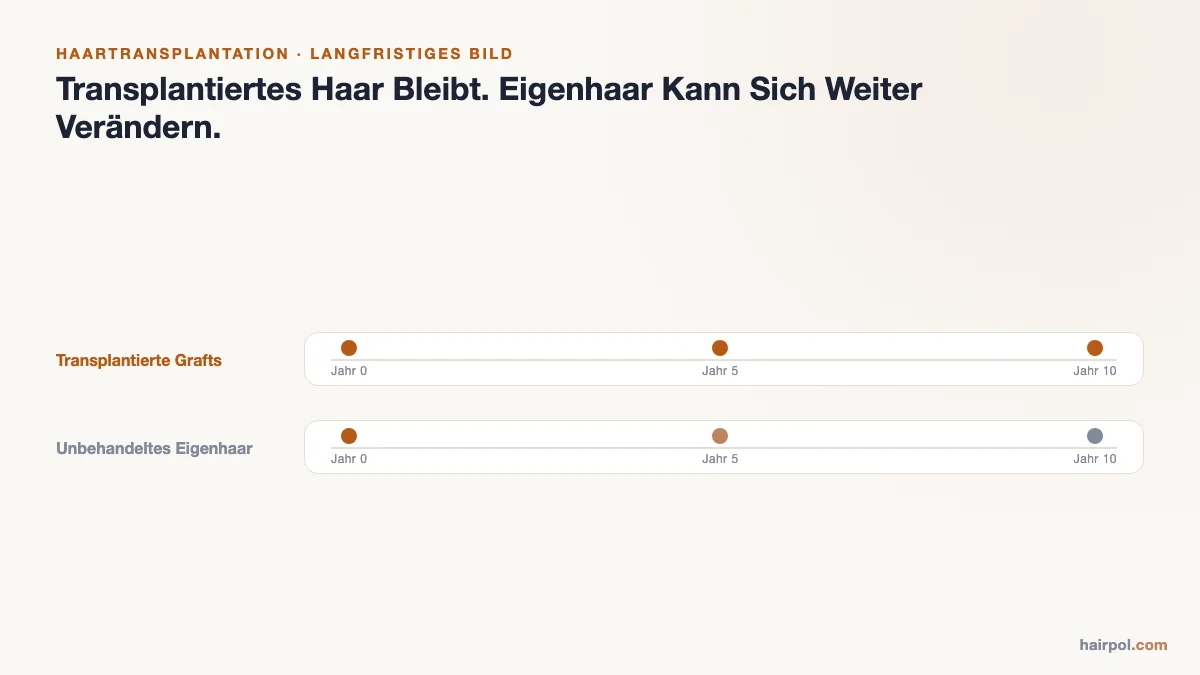 Zeitachse: Stabilität der transplantierten Haare im Vergleich zu Veränderungen im Eigenhaar über 10 Jahre