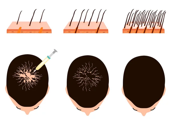 Hair care serum and post-transplant maintenance products on a bathroom shelf