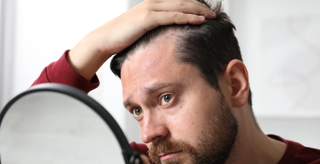 Temple corners showing the difference between a mature hairline and early recession