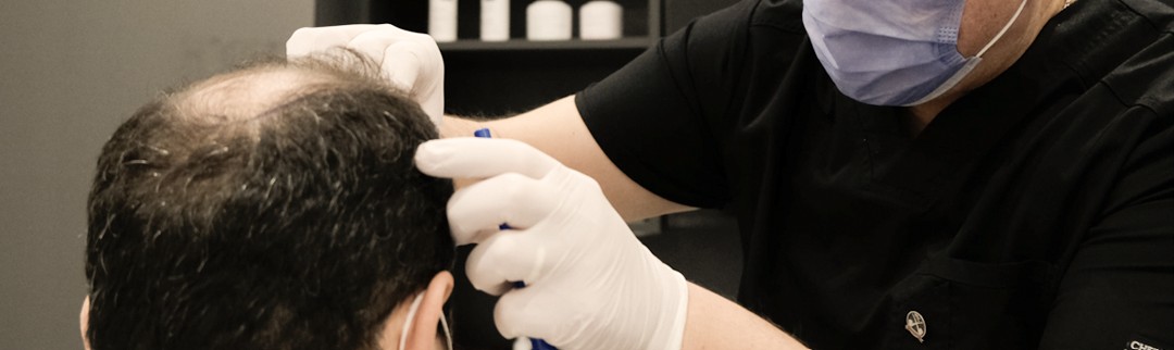 Surgeon examining a patient's thinning crown before planning a density session