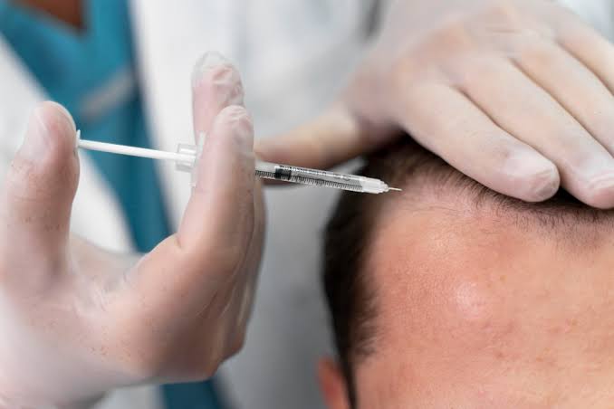 Magnified scalp view showing mixed hair calibre in thinning areas