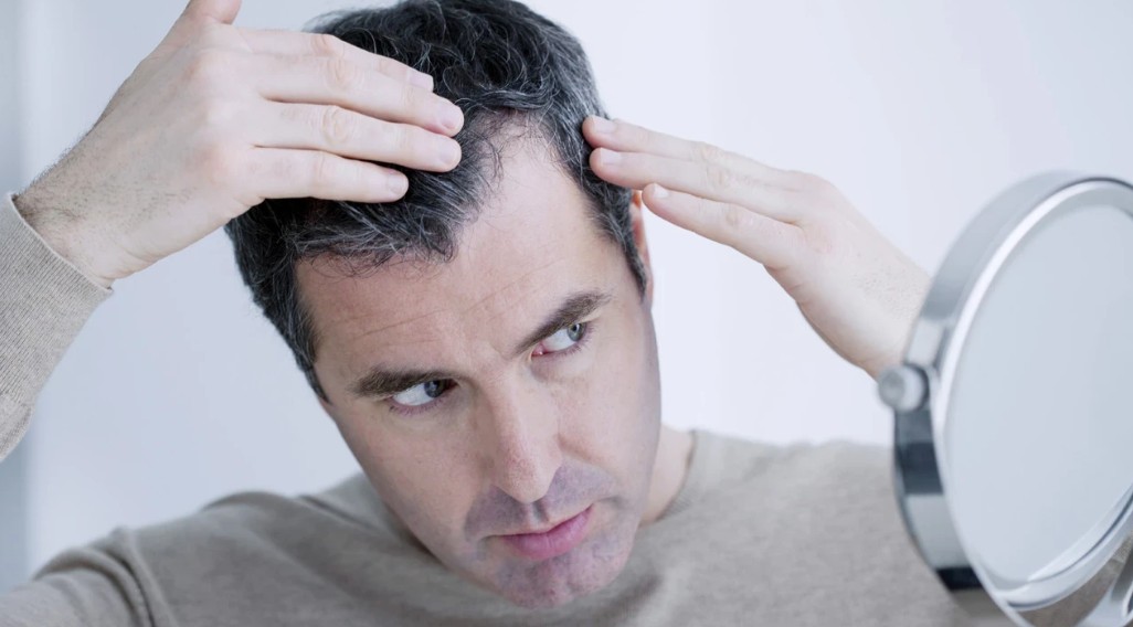 Donor area examined for miniaturisation before a diffuse thinning decision