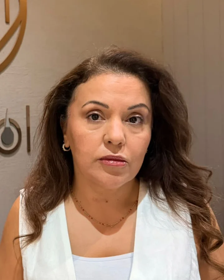 Fulya D. - Patient Coordinator, Hairpol